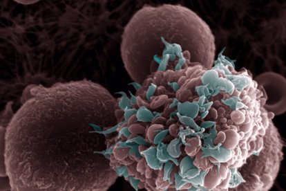 Imatge d'una cèl·lula tumoral envoltada de plaquetes