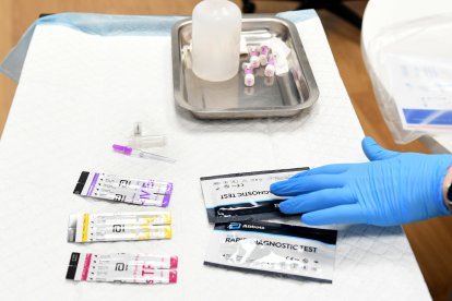 Els testos ràpids que es faciliten per detectar ITS.