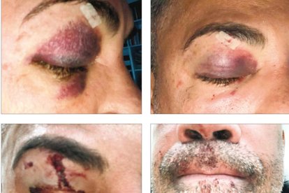 La víctima de l'agressió homòfoba  es mobilitza per denunciar els fets