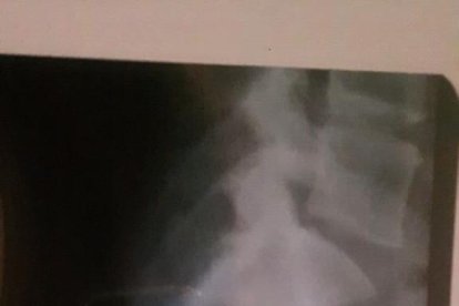 La dona víctima dels trets té el balí al cos i no es pot operar