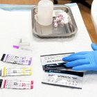 Els testos ràpids que es faciliten per detectar ITS.