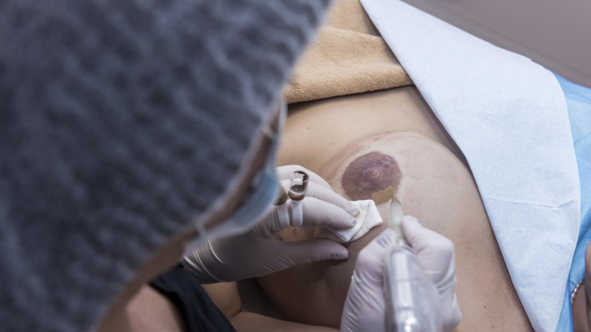 Recuperar la imatge després del càncer