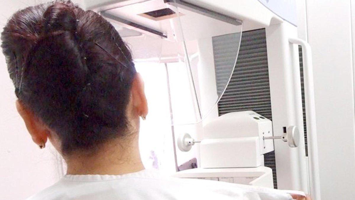 El pla de detecció precoç de càncer de pit permet trobar 79 tumors