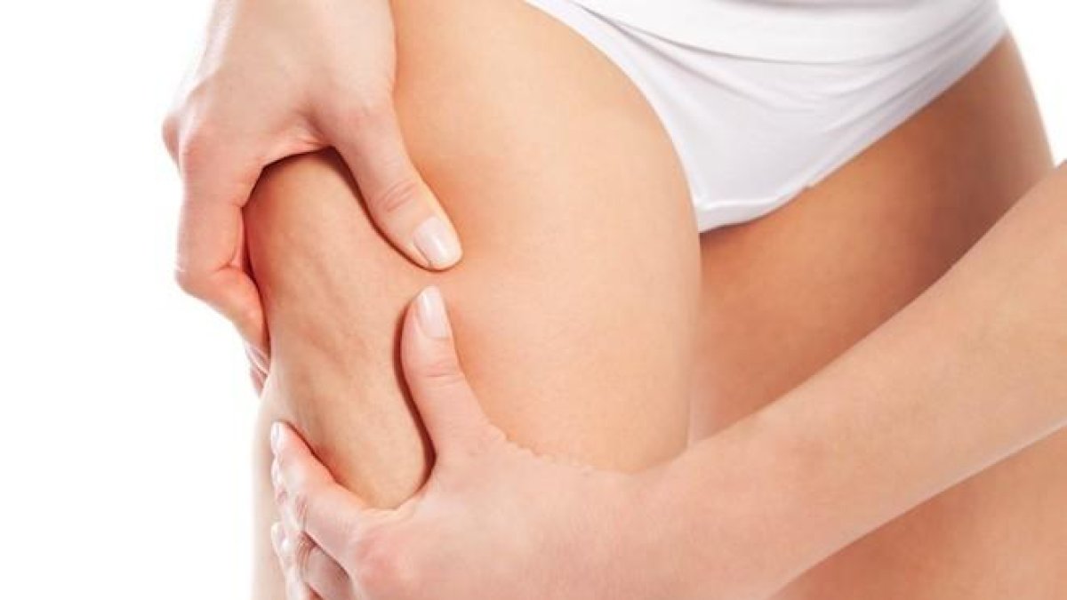 Consells per combatre la cel·lulitis