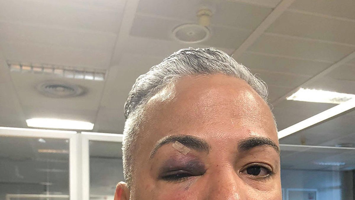 La víctima de l'agressió homòfoba  es mobilitza per denunciar els fets