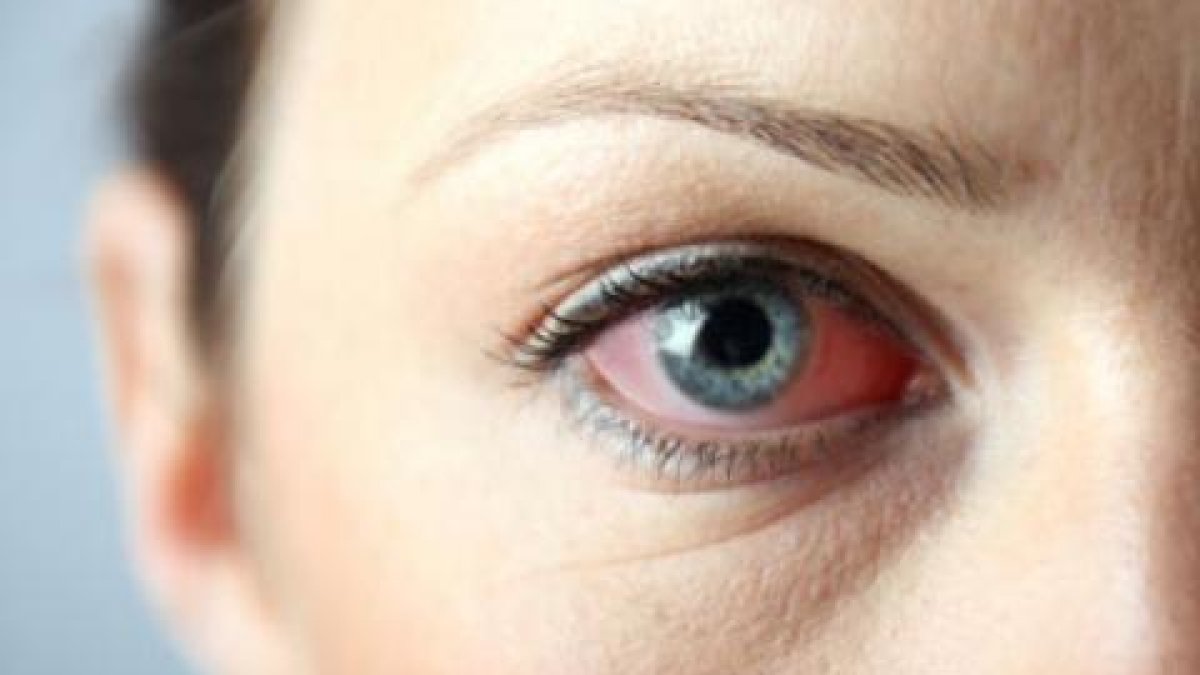 Pol·len i la visió