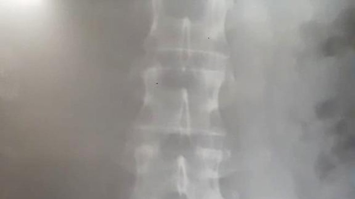 La dona víctima dels trets té el balí al cos i no es pot operar