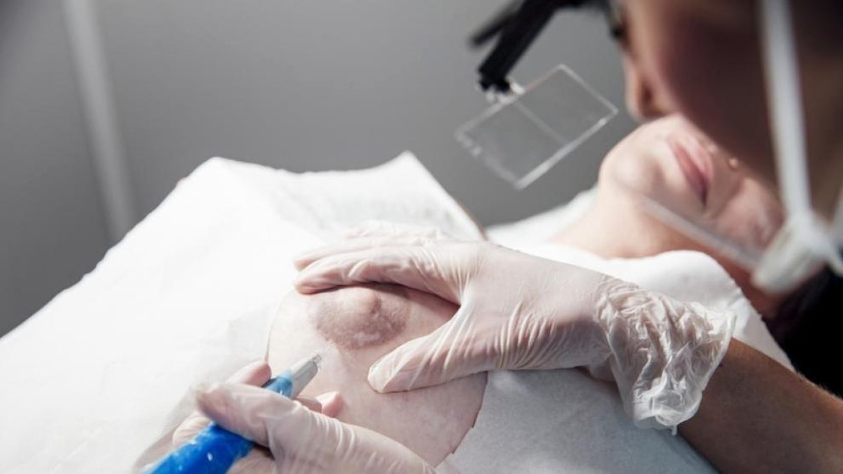 Demanen que es financi la micropigmentació mamària
