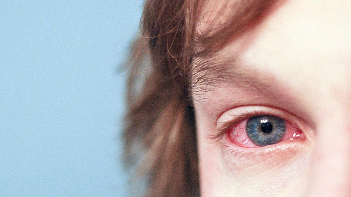 Combatre a la primavera les al·lèrgies