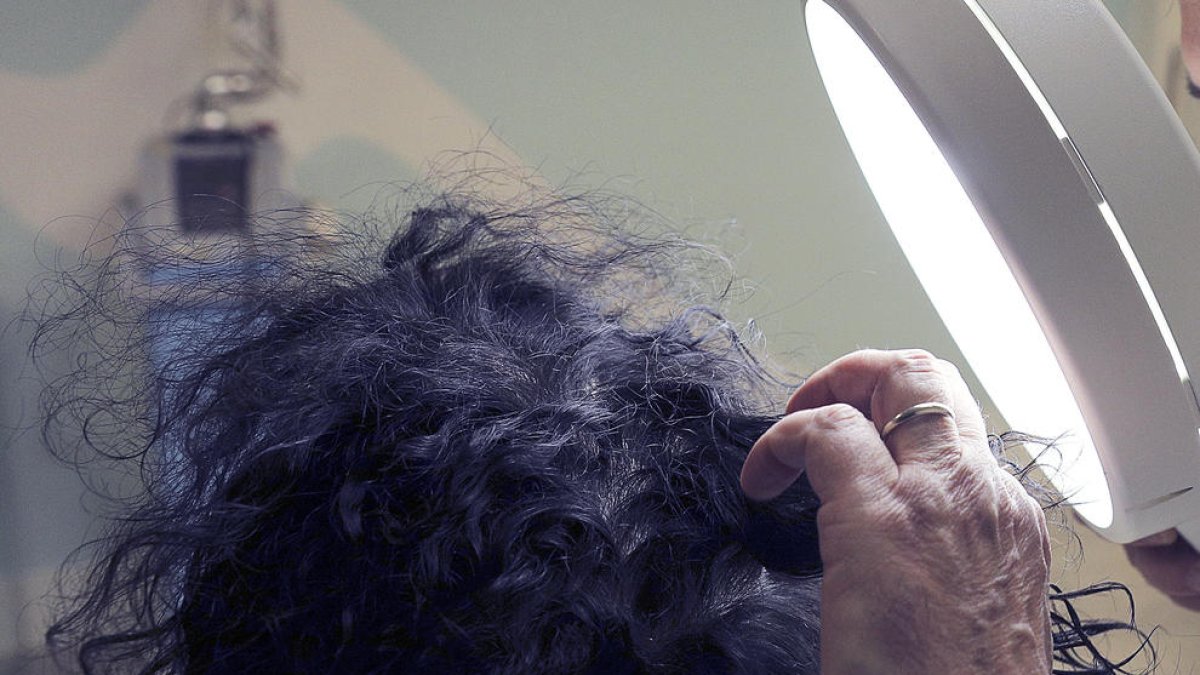 Un dermatòleg revisant la zona capilar d'un pacient.