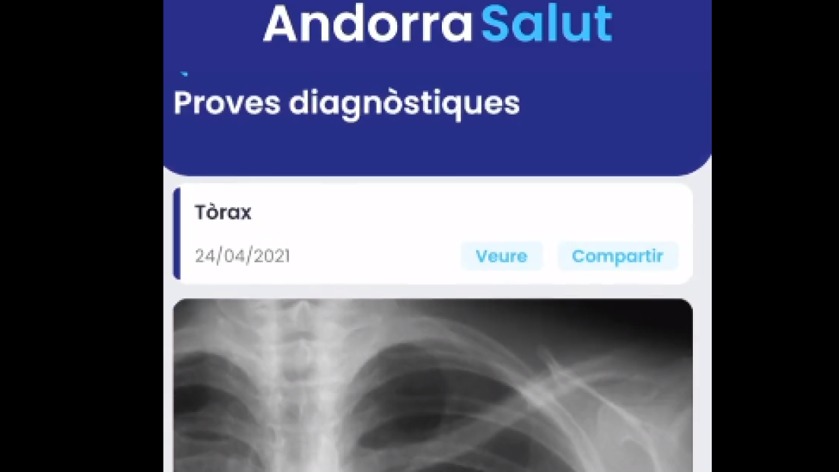 Consulta de les imatges radiològiques amb 'AndSalut'