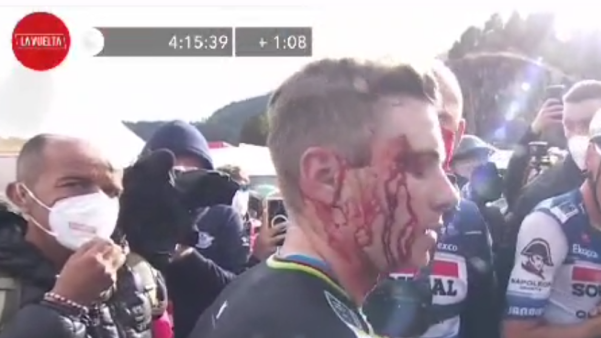 Ferit el ciclista Remco Evenepoe