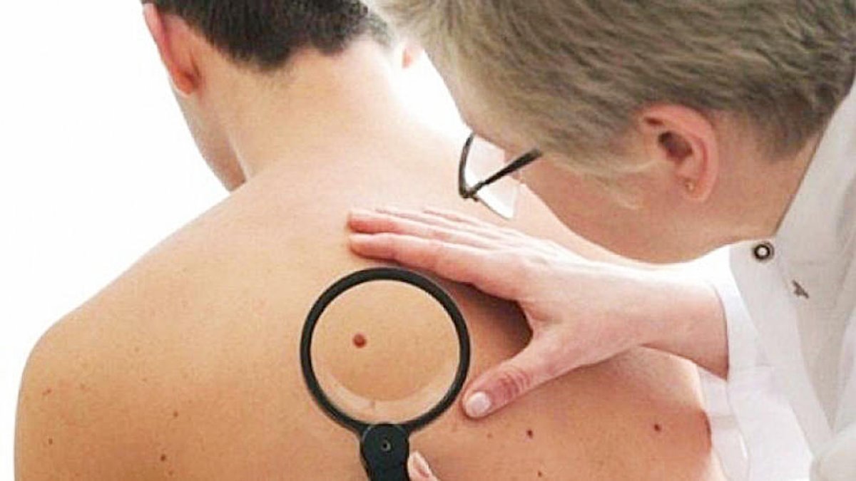 Un pacient a la consulta d'un dermatòleg.