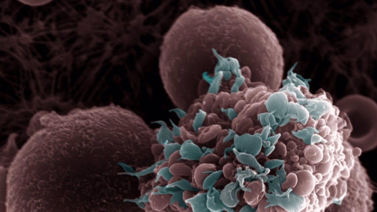 Imatge d'una cèl·lula tumoral envoltada de plaquetes