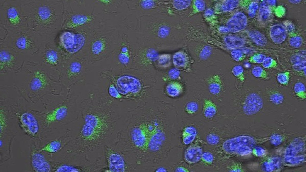 Un compost en investigació aconsegueix reduir la metàstasi en càncer de mama.