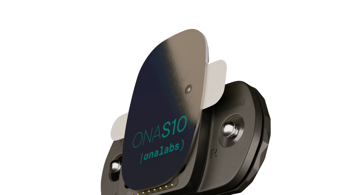 El dispositiu ONASPORT.