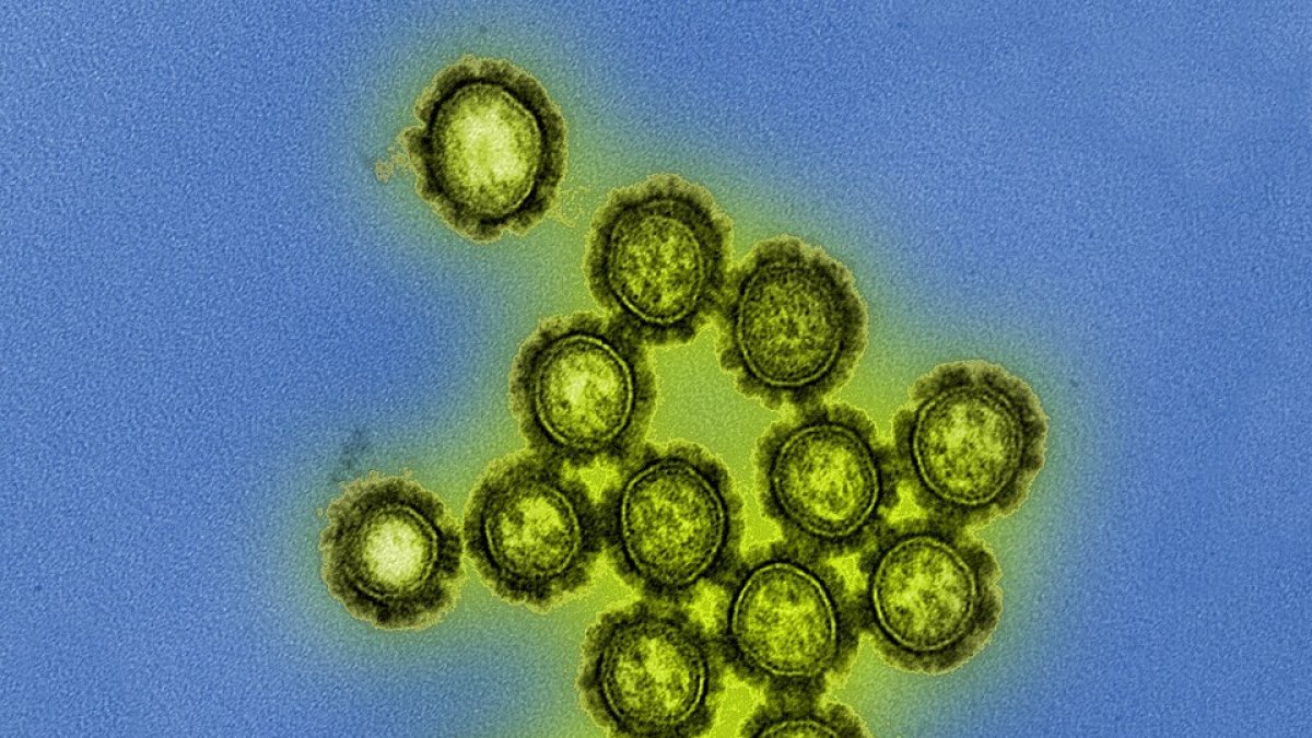 Virus de grip porcina