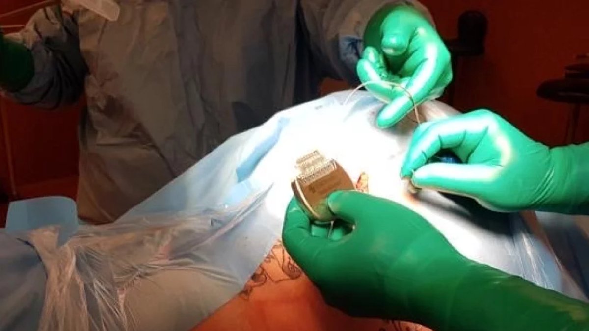 Andorra: Hospital introduces neurostimulation therapy for chronic pain