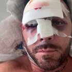 Ferrariman recuperant-se a l'hospital